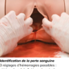 Simulateur d'hémorragie post-partum - P97 – Image 2