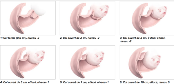 Simulateur de stades d'accouchement – Image 2