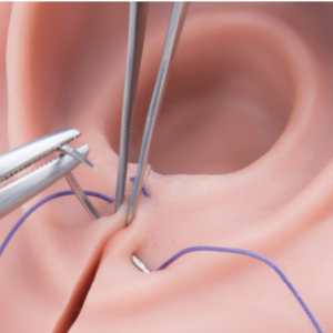 Simulateur d'épisiotomie et de suturation