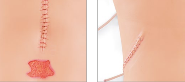 Simulateur de soin des plaies et de pose de bandages – Image 3